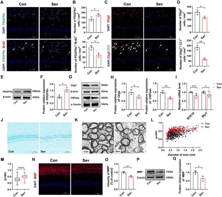 Effects of repeated sevoflurane exposure on OPC proliferation, differentiation, and myelination in neonatal mice. (A) IF staining of PDGFRα (green) and BrdU (red) in the hippocampal CA1 region. Colocalized cells (yellow) are indicated by white arrows, and nuclei were counterstained with DAPI (blue) (scale bar = 100 μm). (B) Quantitative analysis of PDGFRα+ cells and PDGFRα+/BrdU+ double-positive cells; n = 3 mice/group. (C) IF staining of Olig2 (red) and CC1 (green) in the hippocampal CA1 region. Colocalized cells (yellow) are indicated by white arrows, and nuclei were counterstained with DAPI (blue) (scale bar = 100 μm). (D) Quantitative analysis of Olig2+ cells and Olig2+/CC1+ double-positive cells; n = 3 mice/group. (E) WB analysis of PDGFRα protein expression in hippocampal tissue. (F) Quantitative analysis of PDGFRα protein band intensity; n = 3 mice/group. (G) WB analysis of Olig2 and CNPase protein expression in hippocampal tissue.