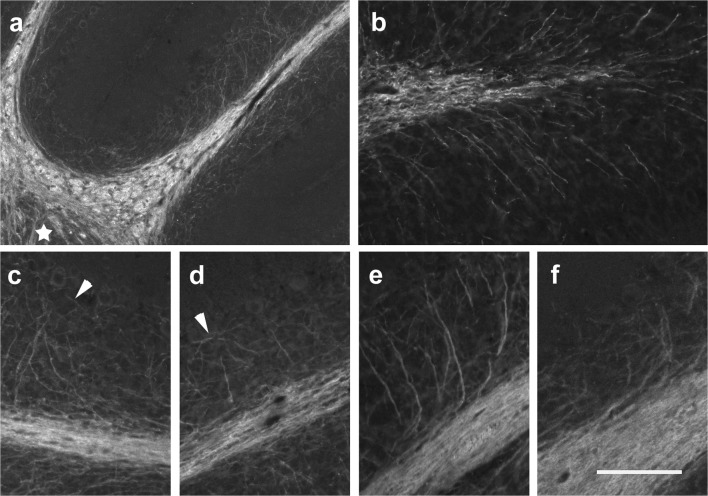 MBP immunoreactivity in the p15 and p28 cerebellum. a–d The p15 cerebellum is characterized by intensive immunoreactivity for MBP throughout the WM. The density of MBP-positive fibers also increased within the DCN (star in a) and the IGL of all lobules. In the proximal parts of the lobules, MBP-positive fibers are found almost up to the PCL (a, c). Distally, MBP-positive fibers do not yet reach the PCL (b, d). At the tips of the lobular WM, MBP-positive fibers branch radially in all directions (b). Arrowheads in c and d point out MBP-positive fibers running more or less parallel to the PCL. e, f In the p28 cerebellum, many MBP-positive fibers ascend through the IGL up to the PCL. Whereas they emanate at flat angles from the white matter in proximal parts of the lobules (e), more distally,