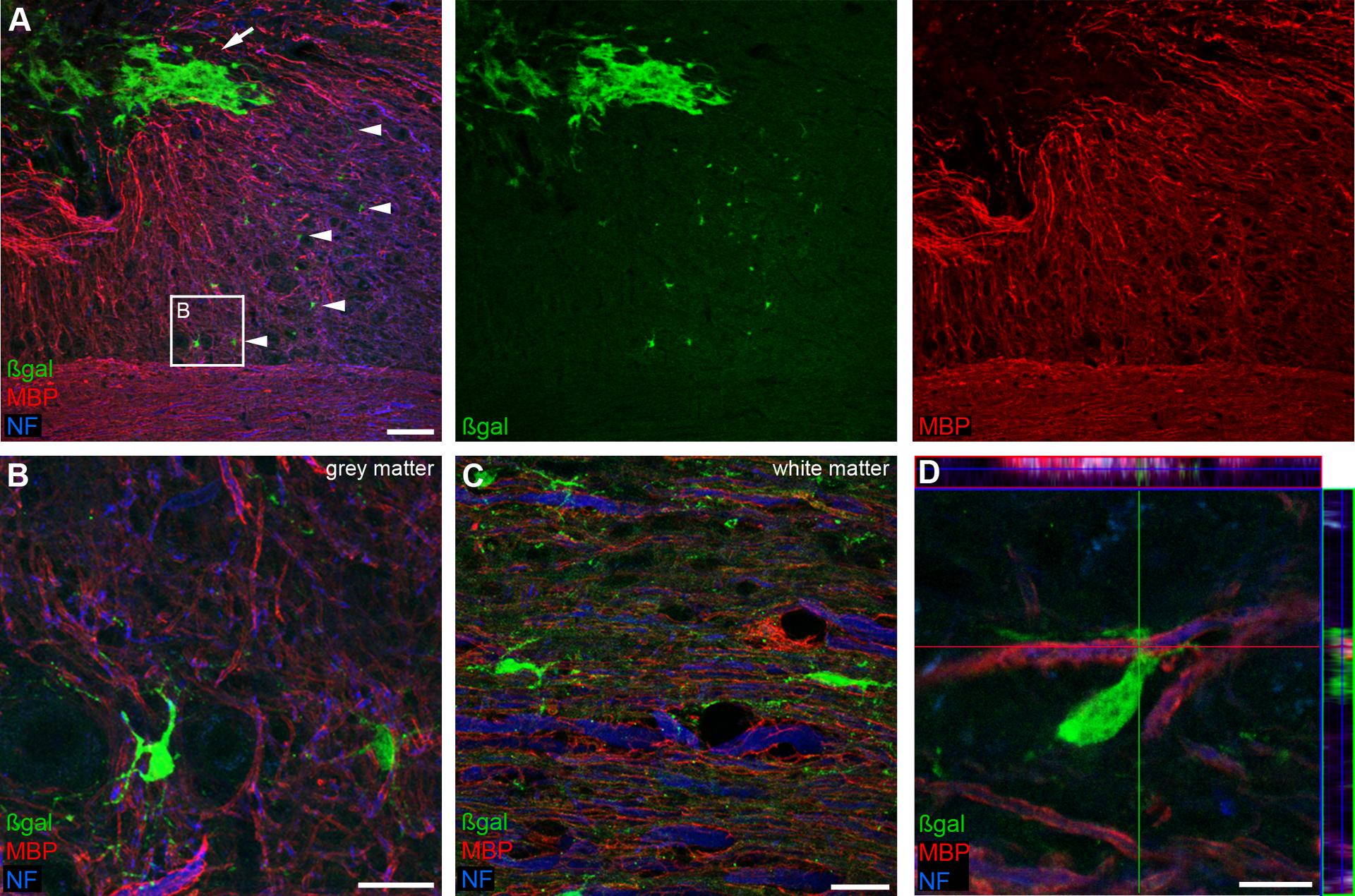 Ependymal cell-derived progeny after spinal cord injury. The image shows ependymal-derived cells immunoreactive for oligodendrocyte markers, demonstrating that ependymal cells can contribute oligodendrocytes to the injury response.