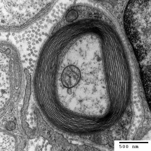 Transmission electron micrograph of a myelinated axon in transverse section. The concentric myelin lamellae are visible surrounding the axon core. The myelin sheath is produced by an oligodendrocyte in the CNS.