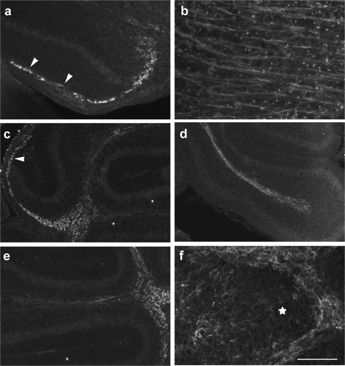 CNP-1 immunoreactivity in the early postnatal mouse cerebellum (p0–p6). a CNP-1-positive cells in the p4 cerebellar anlage are roundish and may be found in the velum medullare (arrowheads in a) and the anteriormost parts of the cerebellar anlage. Sagittal section close to the midline; anterior is to the left. b In the brainstem, CNP-1-positive structures have a fibrous morphology at this age. c, d CNP-1-positive cells at p6. Immunoreactive cells can again be detected in the velum medullare (arrowhead in c). They can now also be seen in the nascent central WM and the nascent WM extending into t