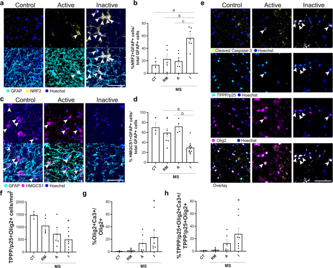 Astrocytic Nrf2 and cholesterol pathways are altered in chronic human brain lesions with poor remyelination potential and oligodendrocyte death. a Nrf2+ (yellow) astrocytes (GFAP+; cyan) (arrows) with Hoechst in blue. Scale bar, 100 μm. e Active caspase-3+ (yellow) oligodendrocytes (TPPP/p25+; cyan, and Olig2+; magenta) (arrows) in control (CT), remyelinated (RM), active (A) and inactive lesions (I) from multiple sclerosis (MS) cases.