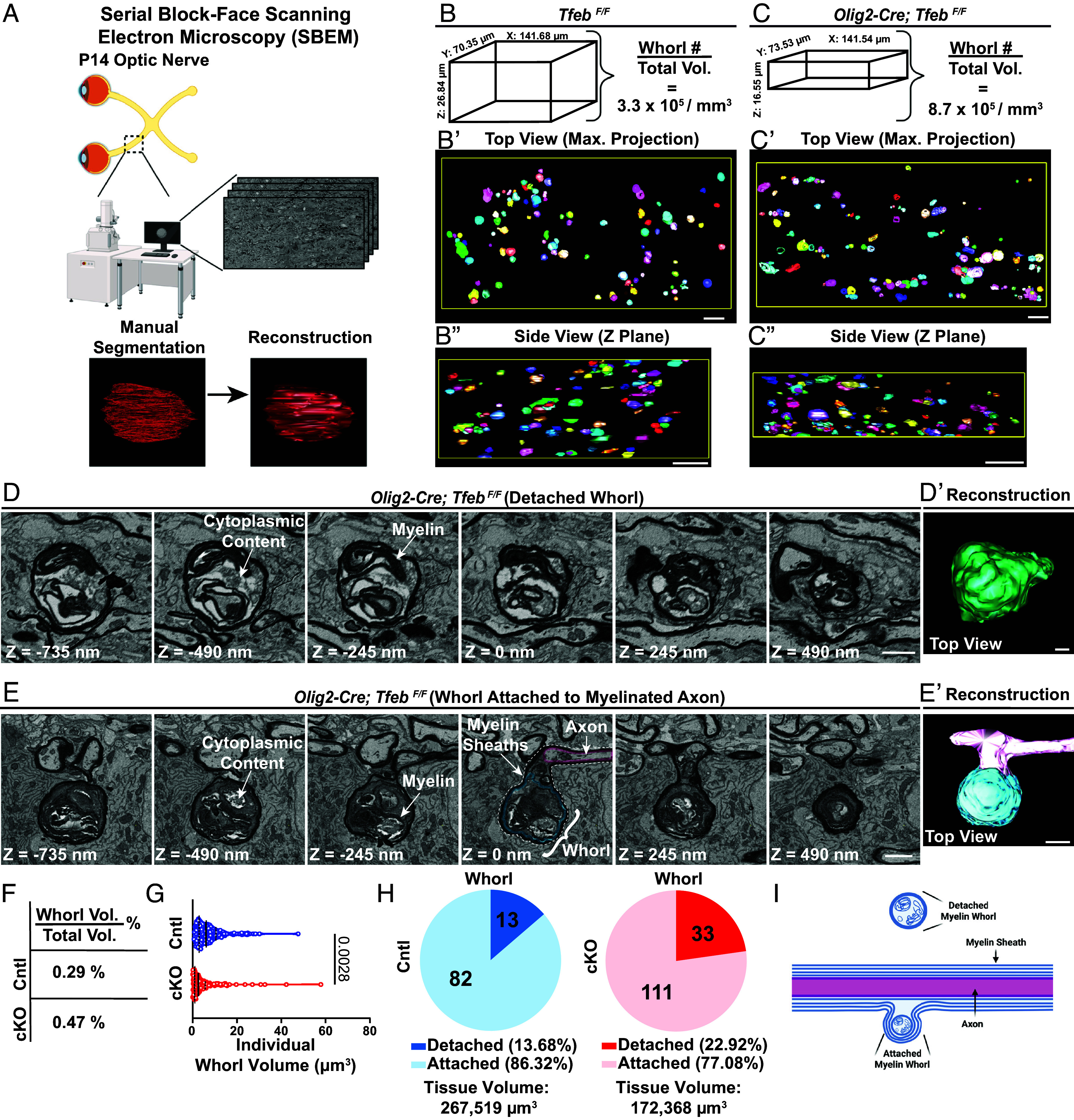 The majority of myelin whorls are located within oligodendrocyte cytosol and are associated with myelinated axons, as revealed by SBEM. ( A ) Workflow for SBEM imaging and analysis of P14 optic nerves, including tissue preparation, SBEM imaging (Z-step size: 35 nm), manual segmentation, and 3D reconstruction. Created in BioRender. ( B-C'') SBEM reconstruction of P14 Tfeb F/F (B-B'') and Olig2-Cre; Tfeb F/F optic nerves (C-C''). ( D and D' ) Representative SBEM sections along the z-axis of a detached whorl (D), and its reconstruction (D') in the Olig2-Cre; Tfeb F/F optic nerve. ( E and E' ) Representative SBEM sections along the z-axis of a whorl associated with a myelinated axon (E), and its reconstruction (E') in the Olig2-Cre; Tfeb F/F optic nerve. The myelin whorl is outlined in blue, while the myelinated axon is outlined in magenta. The dashed line outlines the myelin sheaths that surround the axon and myelin whorl. ( F ) Quantification of the proportion of total whorl volume to the total optic nerve volume imaged by SBEM in P14 Tfeb F/F (Cntl) and Olig2-Cre; Tfeb F/F (cKO) optic nerves. ( G ) Quantification of individual whorl size in P14 control and Tfeb cKO optic nerves. ( H ) Quantification of 'detached' (13.68% in control, 22.92% in Tfeb cKO) and 'attached' whorl percentage (86.32% in control, 77.08% in Tfeb cKO). ( I ) Schematics showing detached myelin whorls and myelin whorls associated with myelinated axons. (Scale bar, 10 um for B', B'', C' and C''; and 1 um in D, D', E, and E').