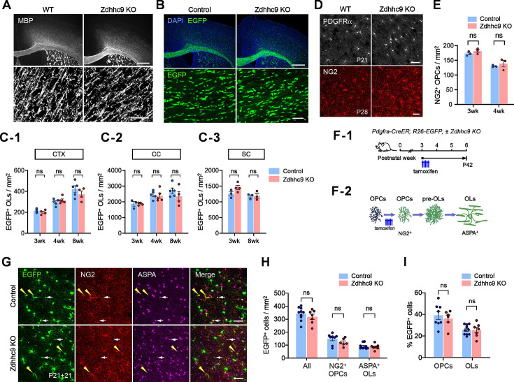 No detectable gross abnormality in oligodendrocyte development in Zdhhc9 KO mice. ( A ) Fluorescent (upper) an