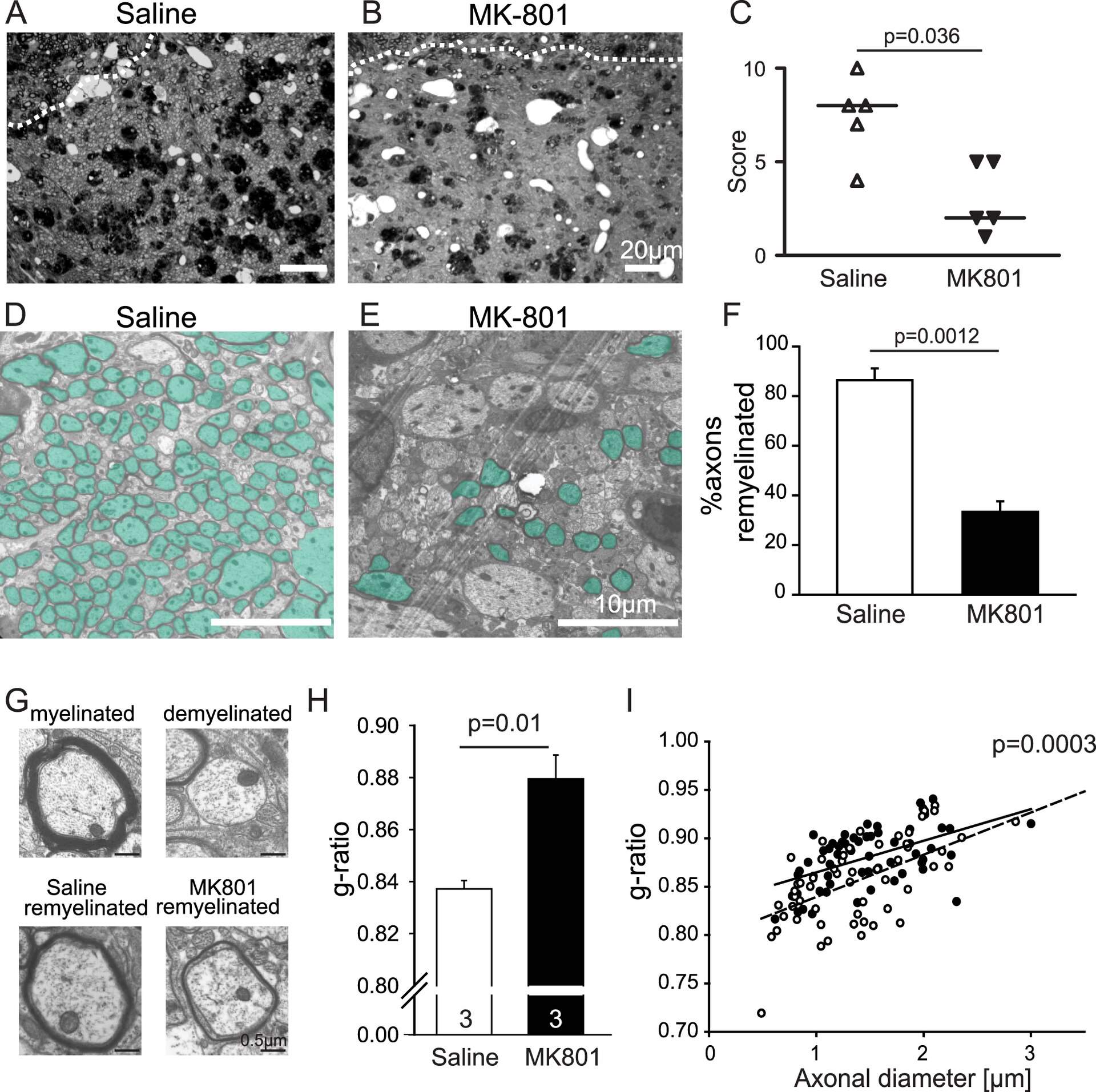 Semithin sections of lesioned cerebellar white matter showing that remyelination is dependent on NMDA receptor activation. Remyelinating axons show thin myelin sheaths characteristic of newly formed oligodendrocyte internodes.