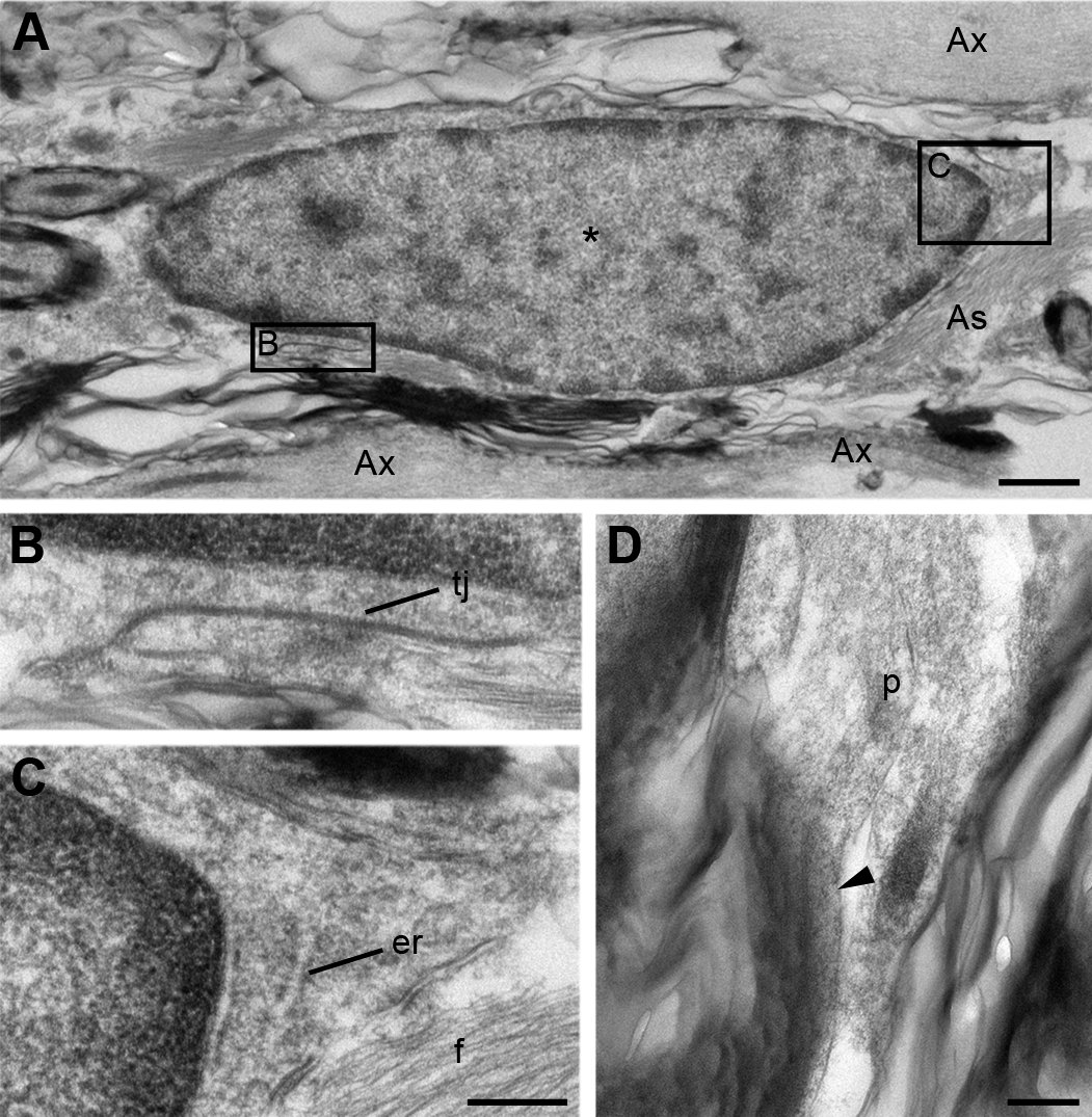 Electron micrograph of an ependyma-derived oligodendrocyte. From Meletis et al., showing the ultrastructure of an oligodendrocyte that arose from ependymal cells after spinal cord injury.