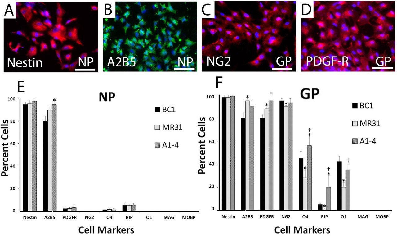 Indirect immunofluorescence defining the early stages of oligodendrocyte differentiation from iPSCs into neural progenitors (NP) and glial progenitors (GP).