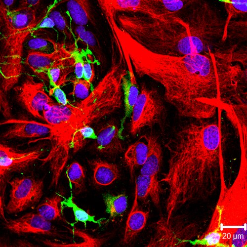 Confocal fluorescence image of rat oligodendrocyte precursor cells (OPCs). NG-2-positive OPCs in green, GFAP-positive astrocytes in red, nuclei counterstained with Hoechst 33342 in blue. Two distinct cell types from a mixed glial culture.
