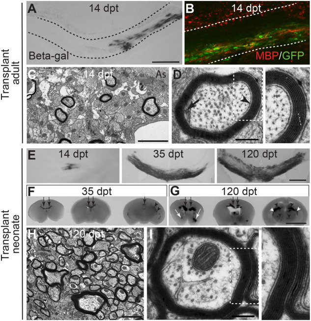 Neural precursors form compact myelin sheaths after transplantation into adult or neonatal Plp1-tg mice. ( A ) Light microscopy image of beta galactosidase-positive cells in the corpus callosum (delineated) of a Plp1-tg transplant recipient, 14 days post transplantation. ( B ) Corpus callosum of another transplant recipient showing that transplanted GFP-positive neurospheres form MBP-positive myelin. ( C and D ) Electron micrographs showing that the transplanted cells generate oligodendrocytes that wrap axons with normal-appearing myelin sheaths in which the inner tongue (black arrow), periaxonal space (arrowhead)